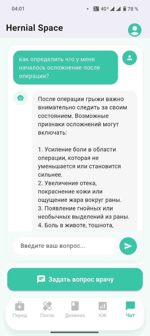 ИИ-консультант